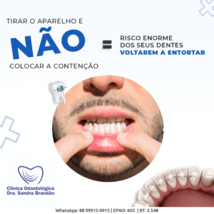 Tirar o aparelho e não colocar a contenção – Clínica Odontológica Dra ...
