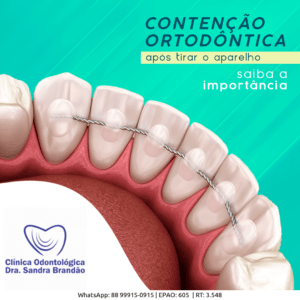 M&aacute;scara Facial Dental Ajustable De Ortodoncia Con Tiro